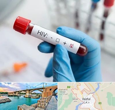 آزمایشگاه ایدز در دزفول