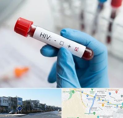 آزمایشگاه ایدز در شریعتی مشهد