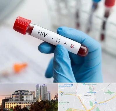 آزمایشگاه ایدز در فرشته 