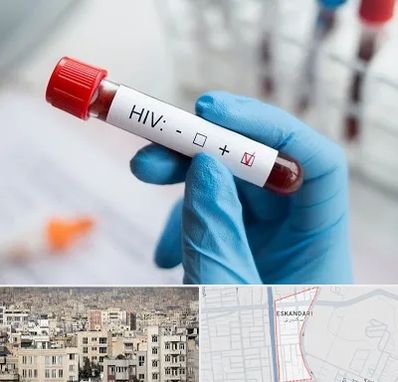 آزمایشگاه ایدز در اسکندری