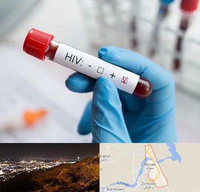 آزمایشگاه ایدز در میناب