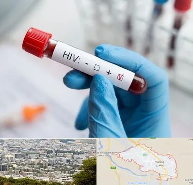 آزمایشگاه ایدز در یاسوج