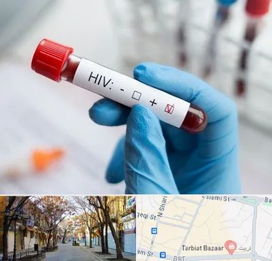 آزمایشگاه ایدز در تربیت تبریز