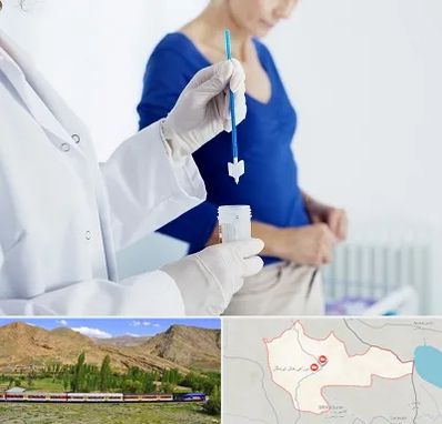 آزمایشگاه پاپ اسمیر در خاش