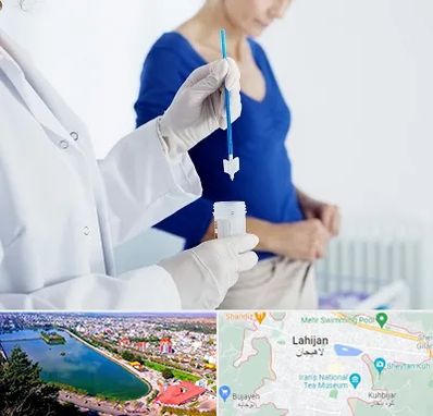 آزمایشگاه پاپ اسمیر در لاهیجان