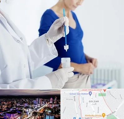 آزمایشگاه پاپ اسمیر در گلسار رشت 