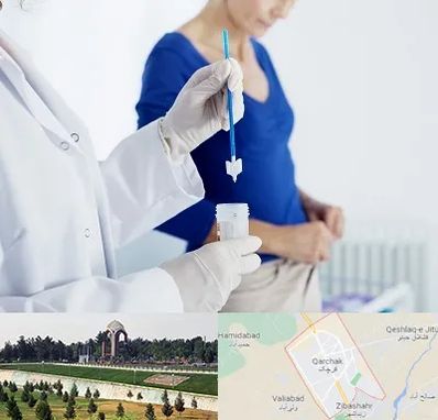 آزمایشگاه پاپ اسمیر در قرچک