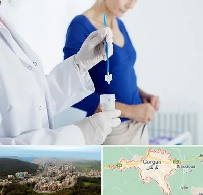 آزمایشگاه پاپ اسمیر در گرگان