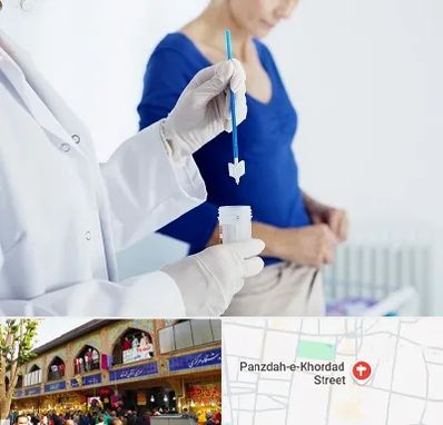 آزمایشگاه پاپ اسمیر در 15 خرداد