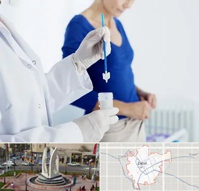 آزمایشگاه پاپ اسمیر در زابل
