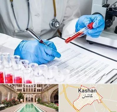 آزمایشگاه اعتیاد در کاشان