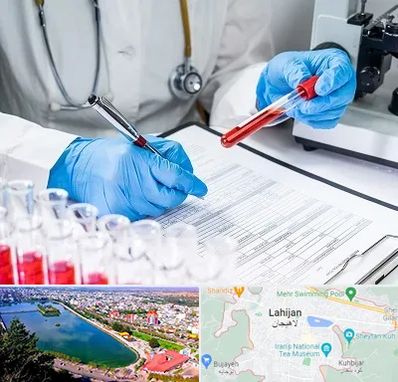 آزمایشگاه اعتیاد در لاهیجان