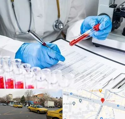 آزمایشگاه اعتیاد در شهناز تبریز