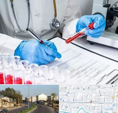 آزمایشگاه اعتیاد در ضیابری رشت