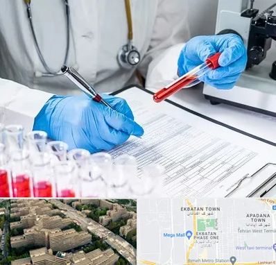 آزمایشگاه اعتیاد در اکباتان 