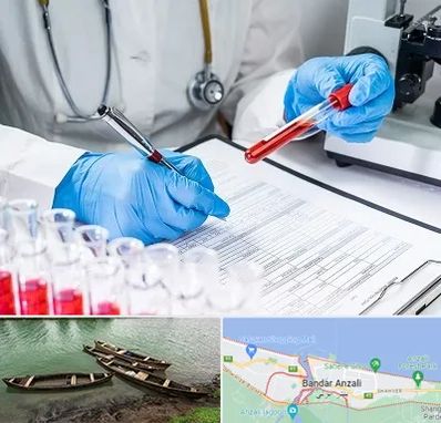 آزمایشگاه اعتیاد در بندر انزلی