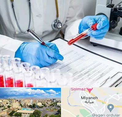 آزمایشگاه اعتیاد در میانه