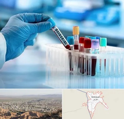 آزمایشگاه خون قبل از ازدواج در اسفراین
