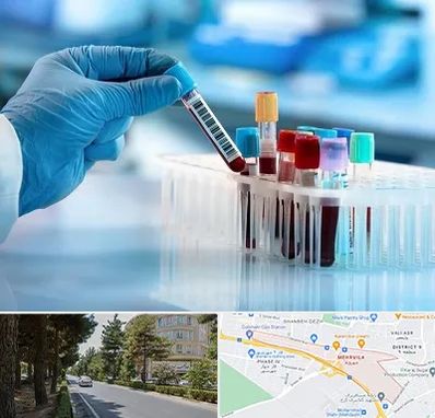 آزمایشگاه خون قبل از ازدواج در مهرویلا کرج