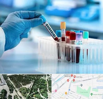 آزمایشگاه خون قبل از ازدواج در سالاریه قم