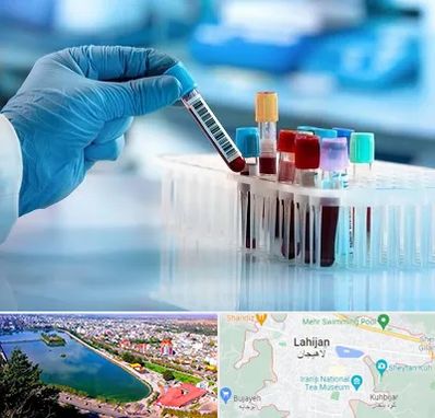 آزمایشگاه خون قبل از ازدواج در لاهیجان