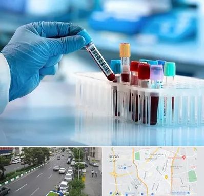 آزمایشگاه خون قبل از ازدواج در ستارخان 