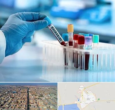 آزمایشگاه خون قبل از ازدواج در بندر ماهشهر