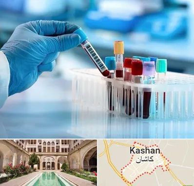 آزمایشگاه خون قبل از ازدواج در کاشان