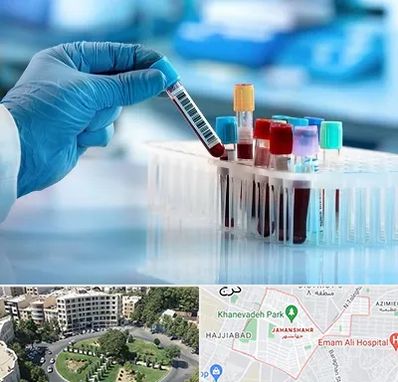 آزمایشگاه خون قبل از ازدواج در جهانشهر کرج 