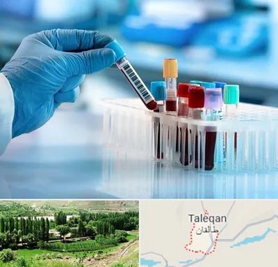 آزمایشگاه خون قبل از ازدواج در طالقان