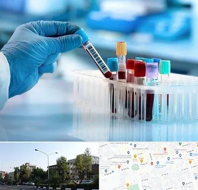 آزمایشگاه خون قبل از ازدواج در میدان کاج 