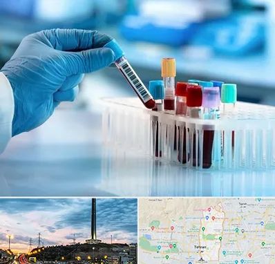 آزمایشگاه خون قبل از ازدواج در منطقه 2 تهران 