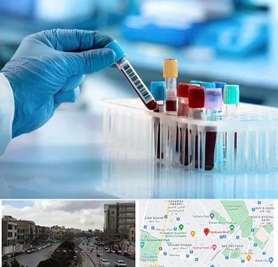آزمایشگاه خون قبل از ازدواج در بلوار فردوسی مشهد