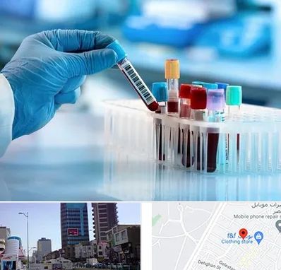 آزمایشگاه خون قبل از ازدواج در چهارراه طالقانی کرج