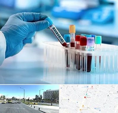 آزمایشگاه خون قبل از ازدواج در بلوار کلاهدوز مشهد