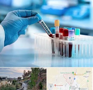 آزمایشگاه خون قبل از ازدواج در باغستان کرج