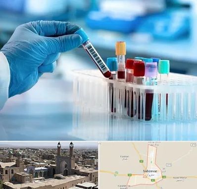 آزمایشگاه خون قبل از ازدواج در سبزوار