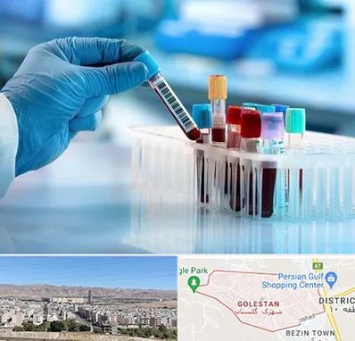 آزمایشگاه خون قبل از ازدواج در شهرک گلستان شیراز