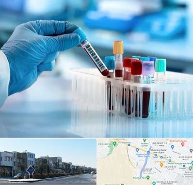 آزمایشگاه خون قبل از ازدواج در شریعتی مشهد
