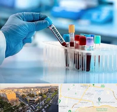 آزمایشگاه خون قبل از ازدواج در تهرانپارس 