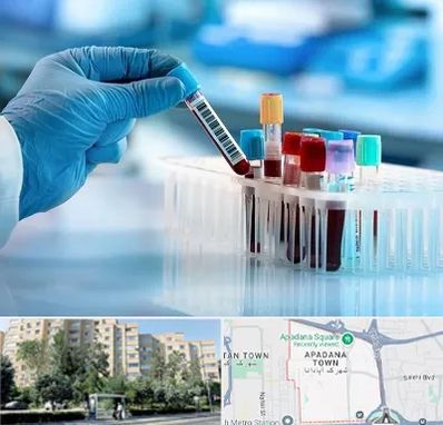 آزمایشگاه خون قبل از ازدواج در آپادانا