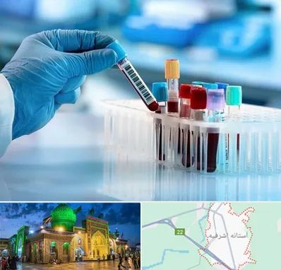 آزمایشگاه خون قبل از ازدواج در آستانه اشرفیه