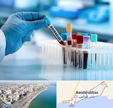 آزمایشگاه خون قبل از ازدواج در بندرعباس