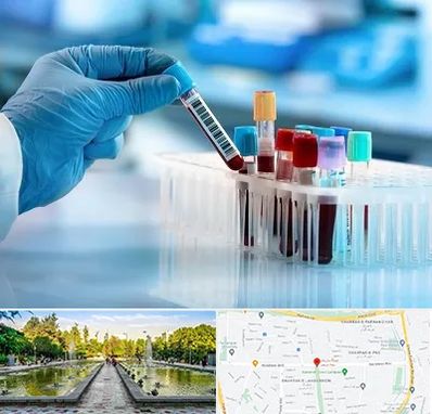 آزمایشگاه خون قبل از ازدواج در سرسبز 