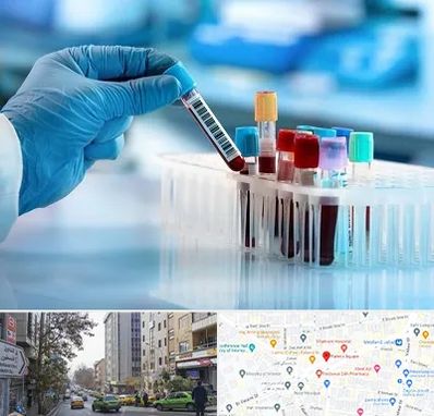 آزمایشگاه خون قبل از ازدواج در فاطمی 