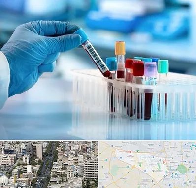 آزمایشگاه خون قبل از ازدواج در منطقه 18 تهران 