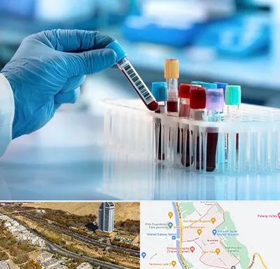 آزمایشگاه خون قبل از ازدواج در خیابان نیایش شیراز