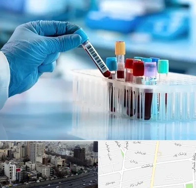 آزمایشگاه خون قبل از ازدواج در زرتشت
