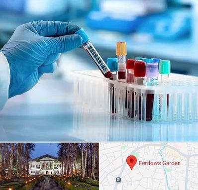 آزمایشگاه خون قبل از ازدواج در باغ فردوس