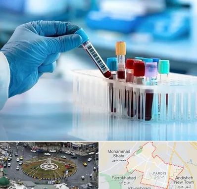 آزمایشگاه خون قبل از ازدواج در فردیس کرج 